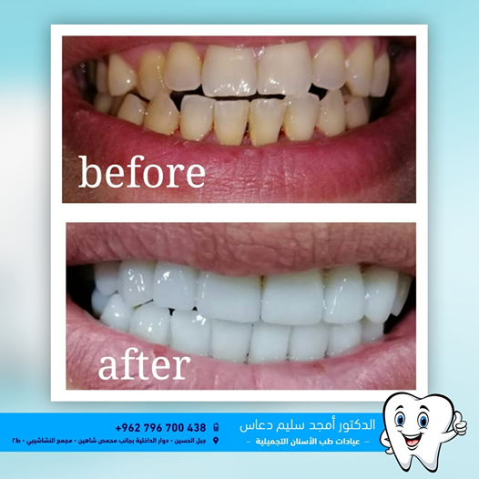 cCosmetic dentist in Amman