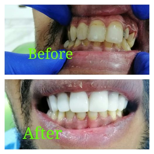 cCosmetic dentist in Amman
