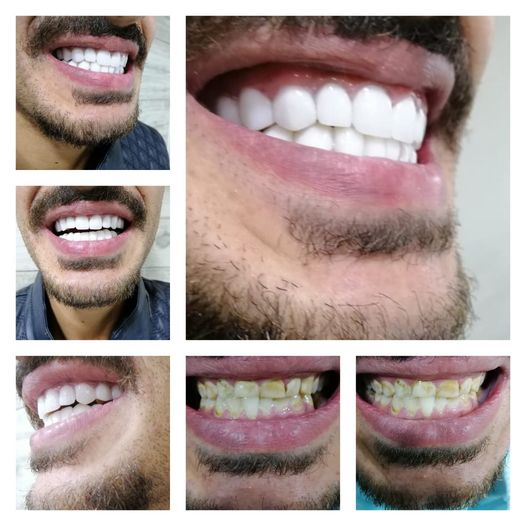 Cosmetic dentist in Amman
